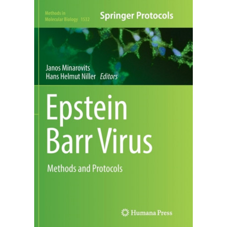 Epstein Barr Virus: Methods and Protocols