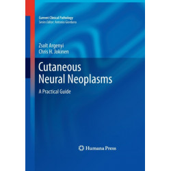 Cutaneous Neural Neoplasms: A Practical Guide