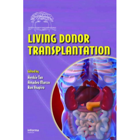 Living Donor Transplantation