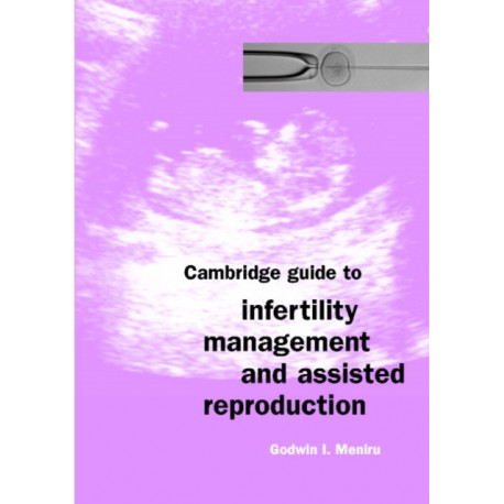 Cambridge Guide to Infertility Management and Assisted Reproduction