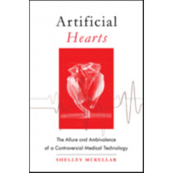 Artificial Hearts: The Allure and Ambivalence of a Controversial Medical Technology