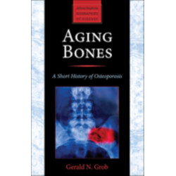 Aging Bones: A Short History of Osteoporosis