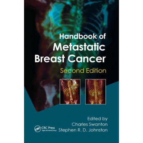 Handbook of Metastatic Breast Cancer