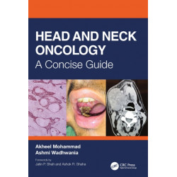 Head and Neck Oncology: A Concise Guide