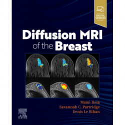 Diffusion MRI of the Breast