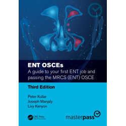 ENT OSCEs: A guide to your first ENT job and passing the MRCS (ENT) OSCE