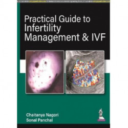 Practical Guide to Infertility Management & IVF