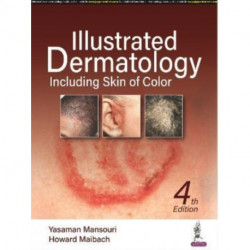 Illustrated Dermatology: Including Skin of Colour