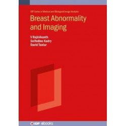 Breast Abnormality and Imaging