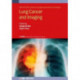 Lung Cancer and Imaging