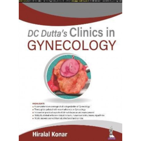 DC Dutta's Clinics in Gynecology