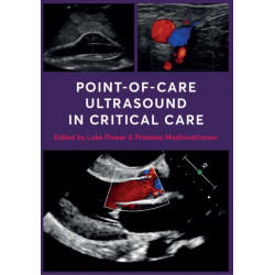 Point-of-Care Ultrasound in Critical Care