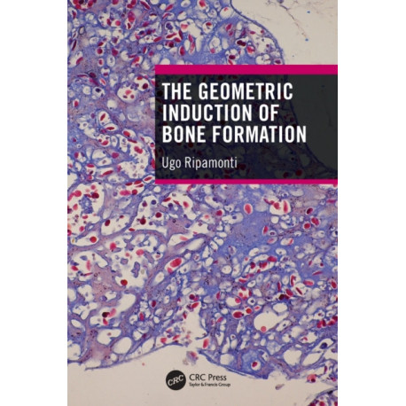 The Geometric Induction of Bone Formation