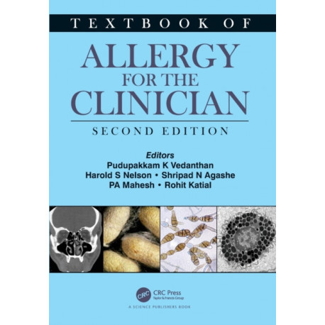 Textbook of Allergy for the Clinician