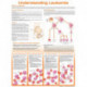 Understanding Leukemia Anatomical Chart