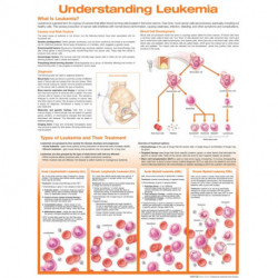 Understanding Leukemia Anatomical Chart