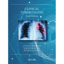 Clinical Tuberculosis