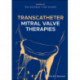 Transcatheter Mitral Valve Therapies