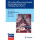 Video Atlas of Neurophysiological Monitoring in Surgery of Infiltrating Brain Tumors