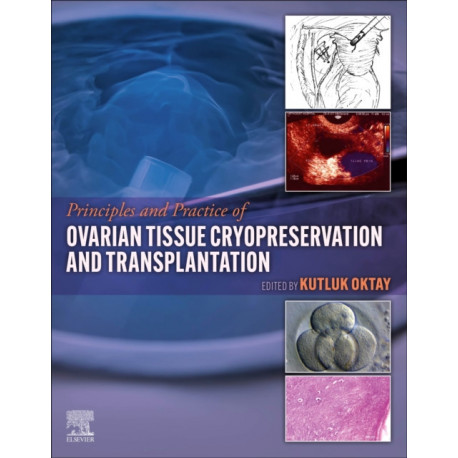 Principles and Practice of Ovarian Tissue Cryopreservation and Transplantation