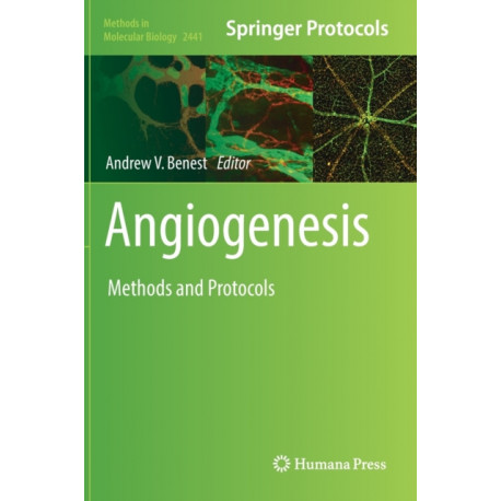 Angiogenesis: Methods and Protocols