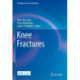 Knee Fractures