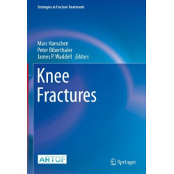 Knee Fractures