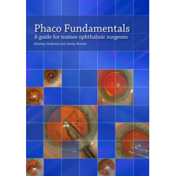 Phaco Fundamentals: A Guide for Trainee Ophthalmic Surgeons
