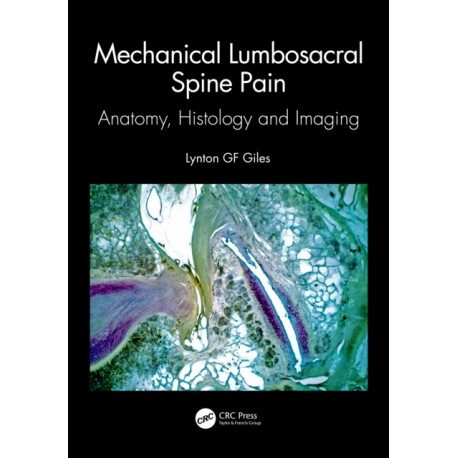 Mechanical Lumbosacral Spine Pain: Anatomy, Histology and Imaging