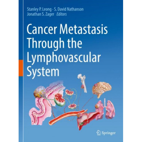Cancer Metastasis Through the Lymphovascular System