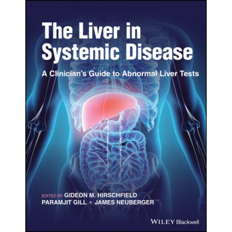The Liver in Systemic Disease: A Clinician's Guide to Abnormal Liver Tests