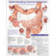 Understanding Colorectal  Cancer Anatomical Chart