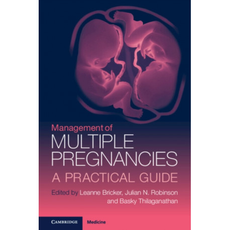 Management of Multiple Pregnancies: A Practical Guide