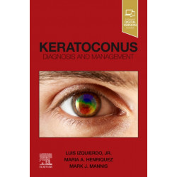Keratoconus: Diagnosis and Management