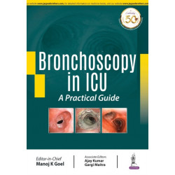 Bronchoscopy in ICU: A Practical Guide
