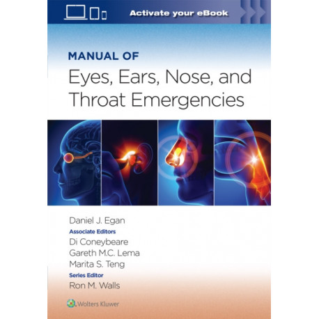 Manual of Eye, Ear, Nose, and Throat Emergencies: Print + eBook with Multimedia