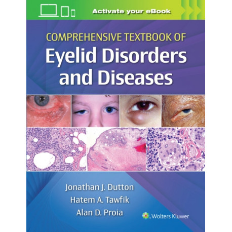 Comprehensive Textbook of Eyelid Disorders and Diseases