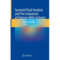 Synovial Fluid Analysis and The Evaluation of Patients With Arthritis