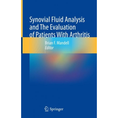 Synovial Fluid Analysis and The Evaluation of Patients With Arthritis