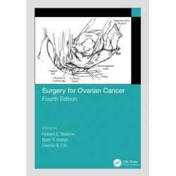 Surgery for Ovarian Cancer