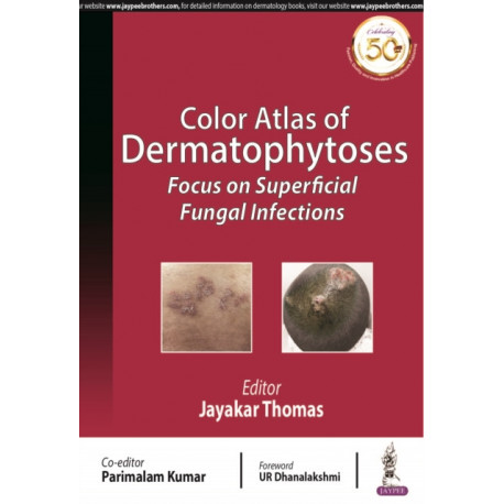 Color Atlas of Dermatophytoses: Focus on Superficial Fungal Infections