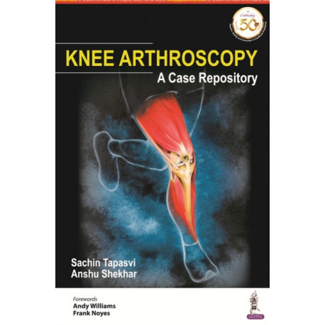 Knee Arthroscopy: A Case Repository