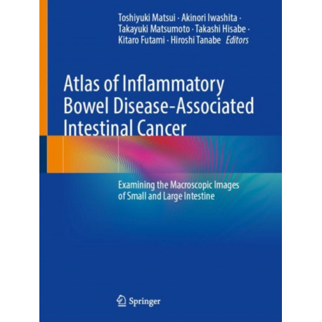 Atlas of Inflammatory Bowel Disease-Associated Intestinal Cancer: Examining the Macroscopic Images of Small and Large Intestine