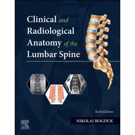 Clinical and Radiological Anatomy of the Lumbar Spine