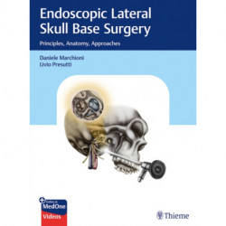 Endoscopic Lateral Skull Base Surgery: Principles, Anatomy, Approaches