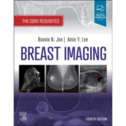 Breast Imaging: The Core Requisites
