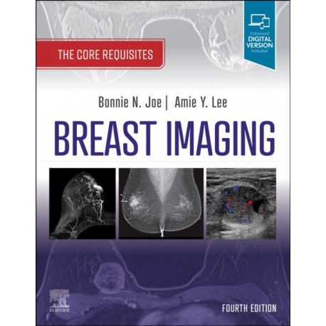Breast Imaging: The Core Requisites