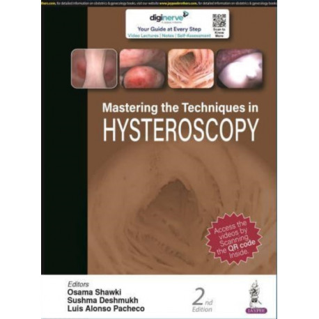 Mastering the Techniques in Hysteroscopy