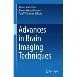 Advances in Brain Imaging Techniques
