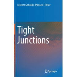 Tight Junctions